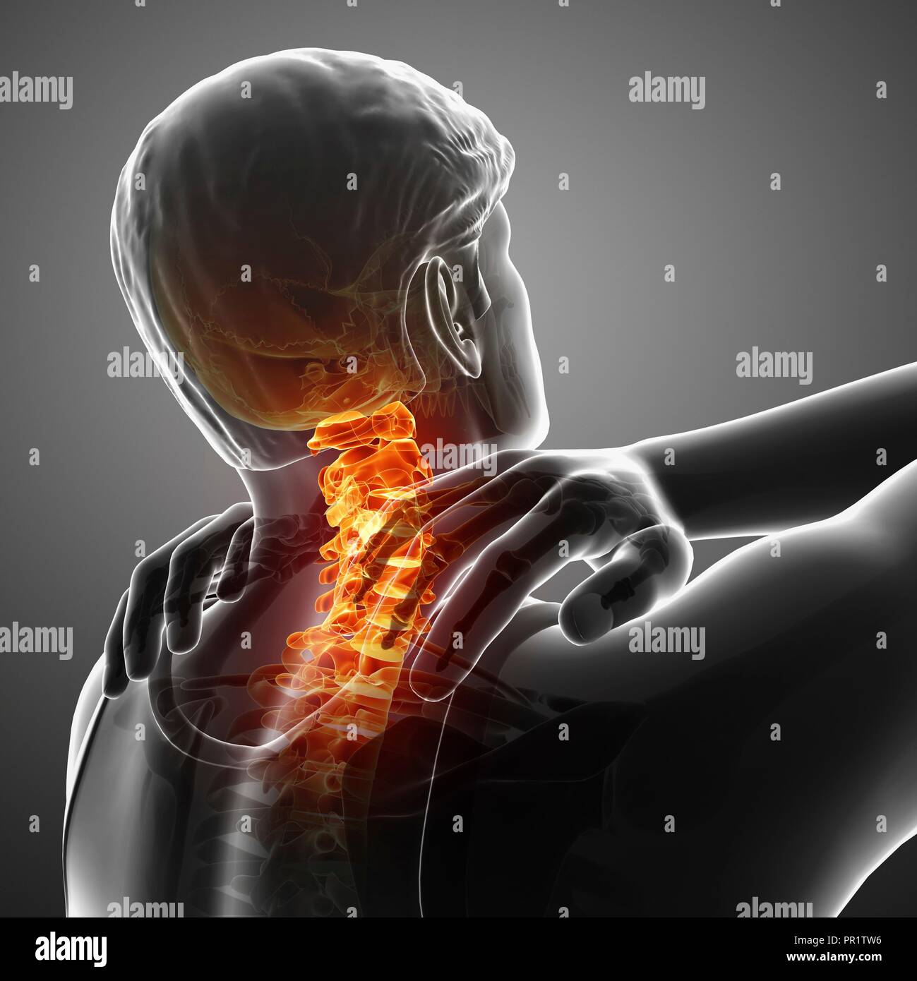 Uomo con dolore al collo, illustrazione del computer. Foto Stock