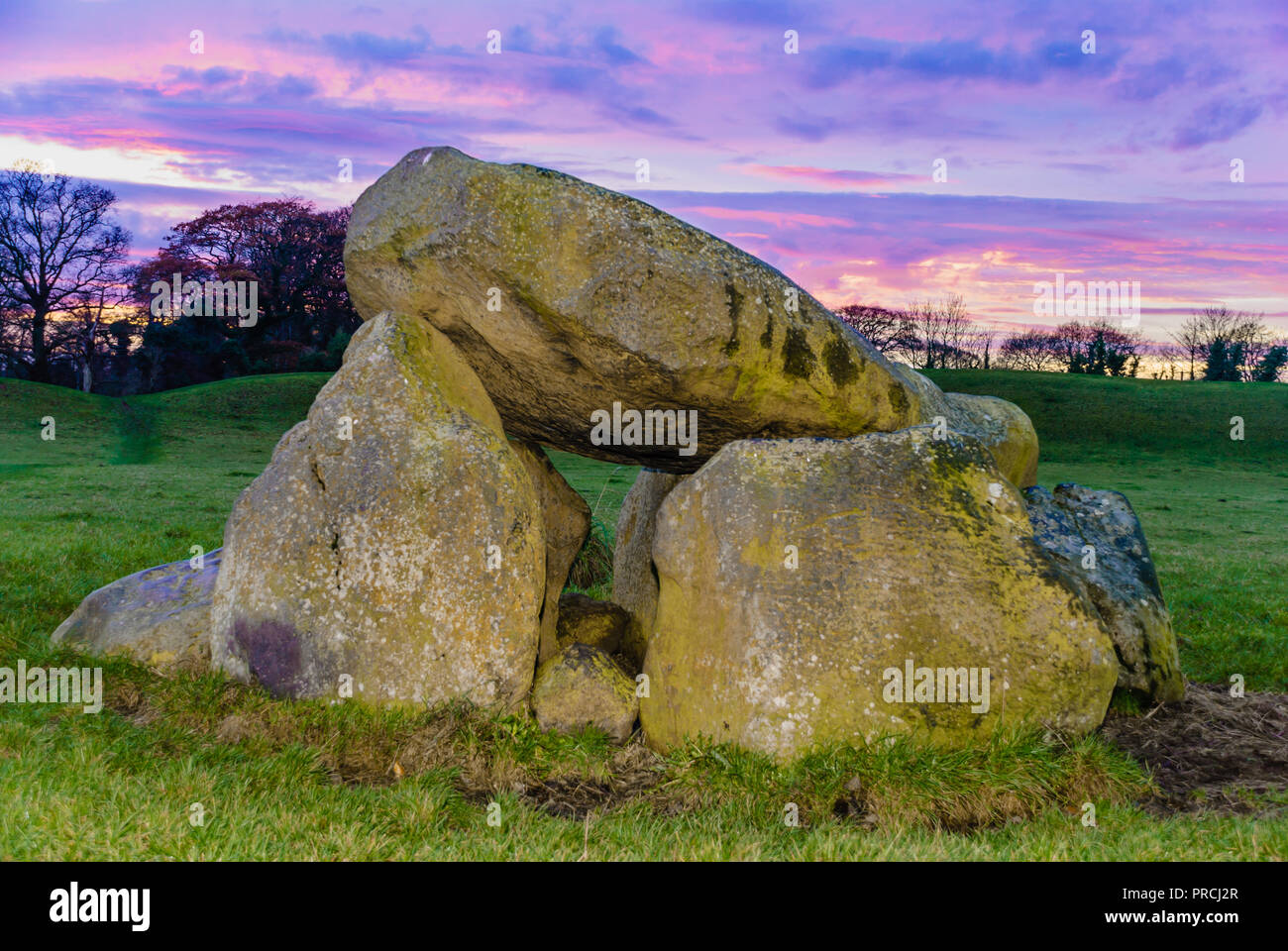 Tradizionale irlandese dolmen di sepoltura al Giant's Ring, Belfast, Irlanda del Nord Foto Stock