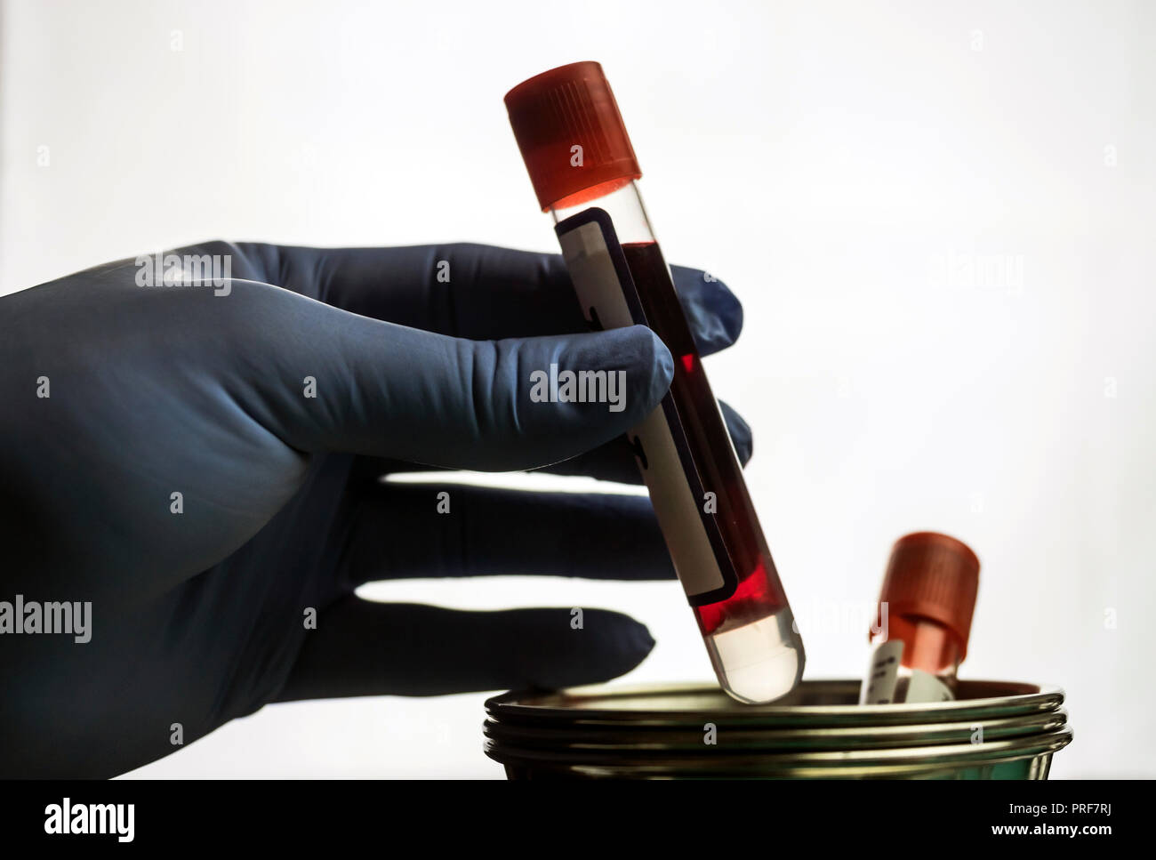 Medico detiene il campione di sangue in un ospedale tabella, immagine concettuale Foto Stock