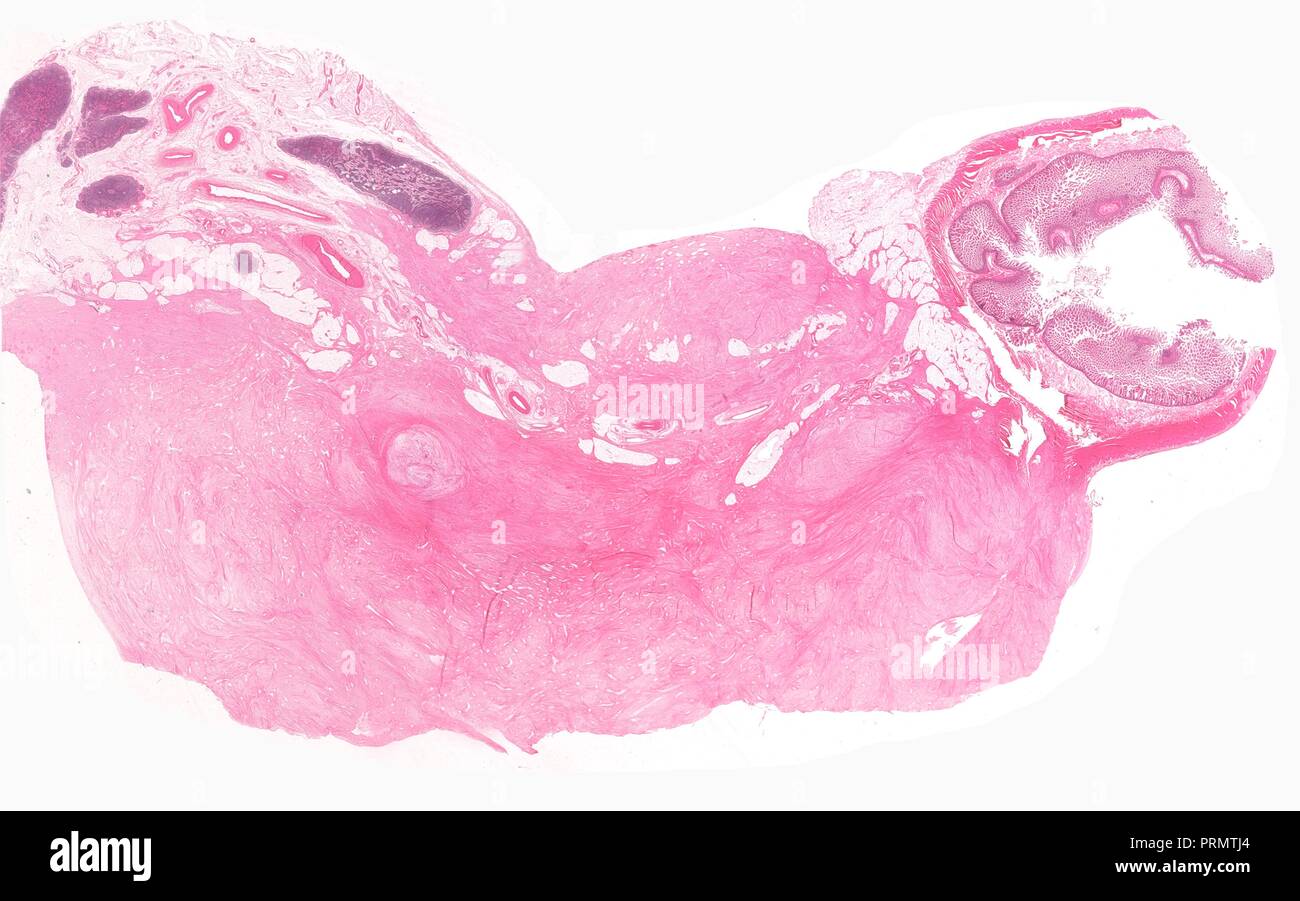 Il tessuto umano fette, close-up di organi interni. Foto Stock