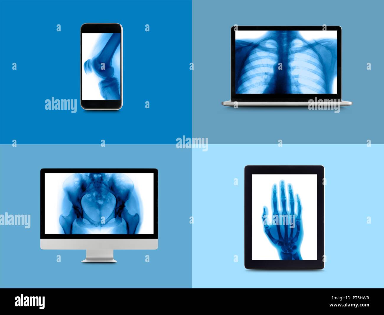 X-ray montage sul dispositivo digitale schermate. Foto Stock