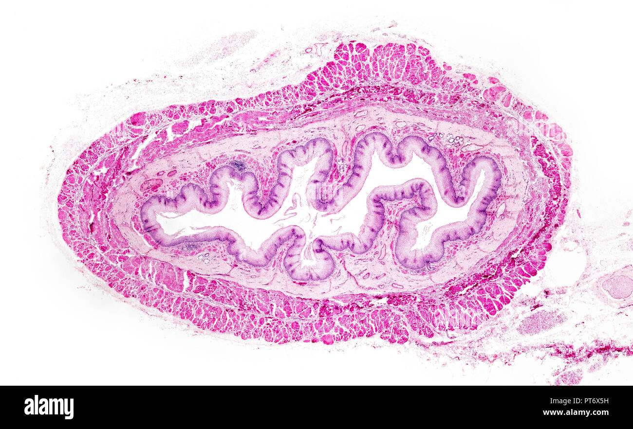 Infant esofago TS, fotomicrografia in campo chiaro Foto Stock