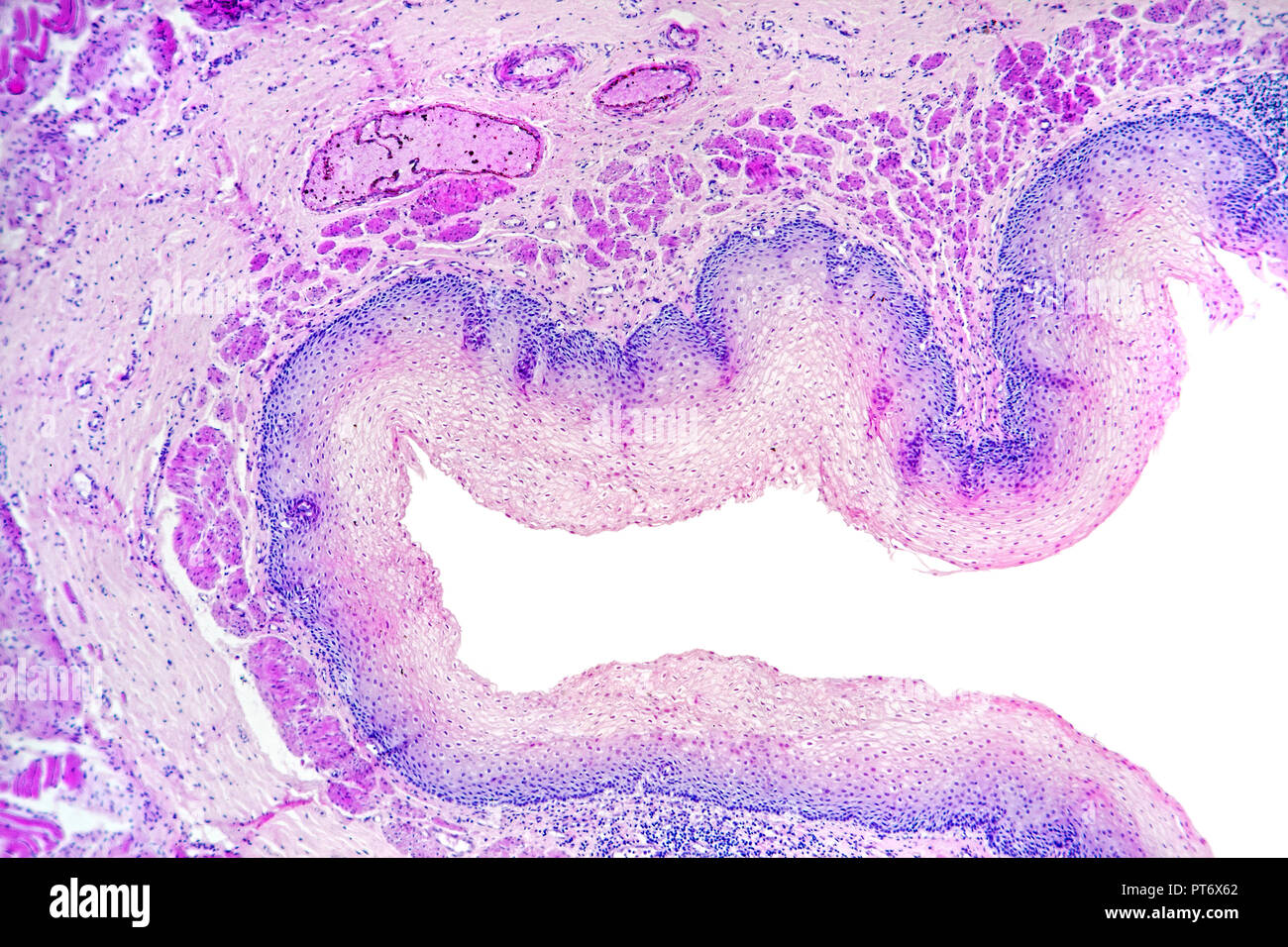 Neonato umano esofago, all'interno della parete Dettaglio, sezione macchiata, TS Foto Stock