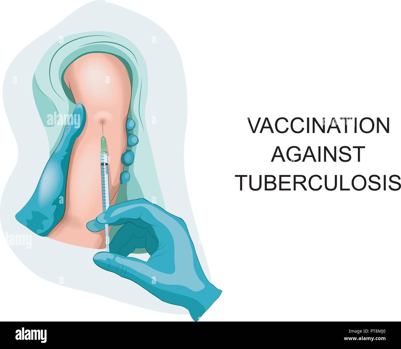 Illustrazione vettoriale di bambino vaccinazione contro la tubercolosi. Illustrazione Vettoriale