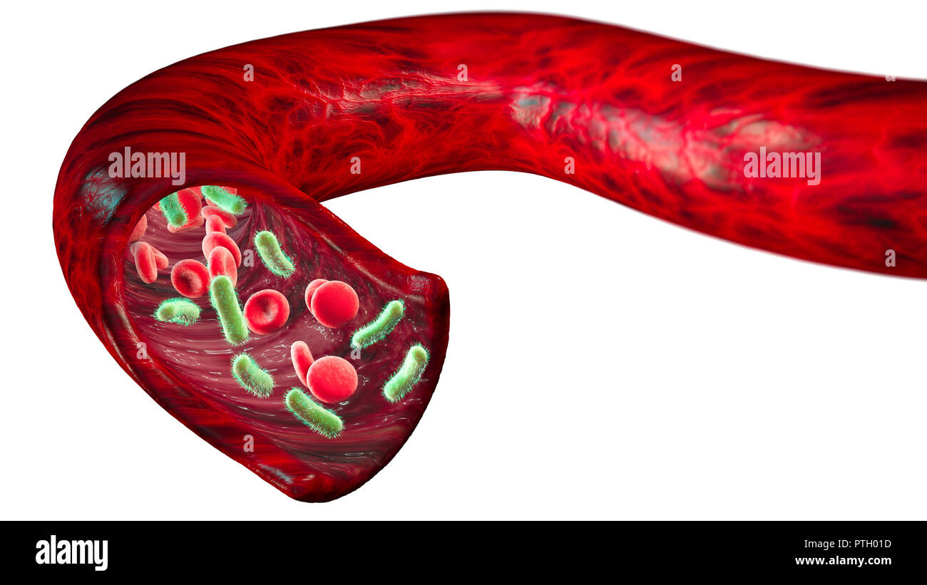 Vena e cellule di sangue rosso attaccato da un virus, circolazione di batteri entro una arteria. Escherichia coli. La sezione di una vena. Il rendering 3D Foto Stock