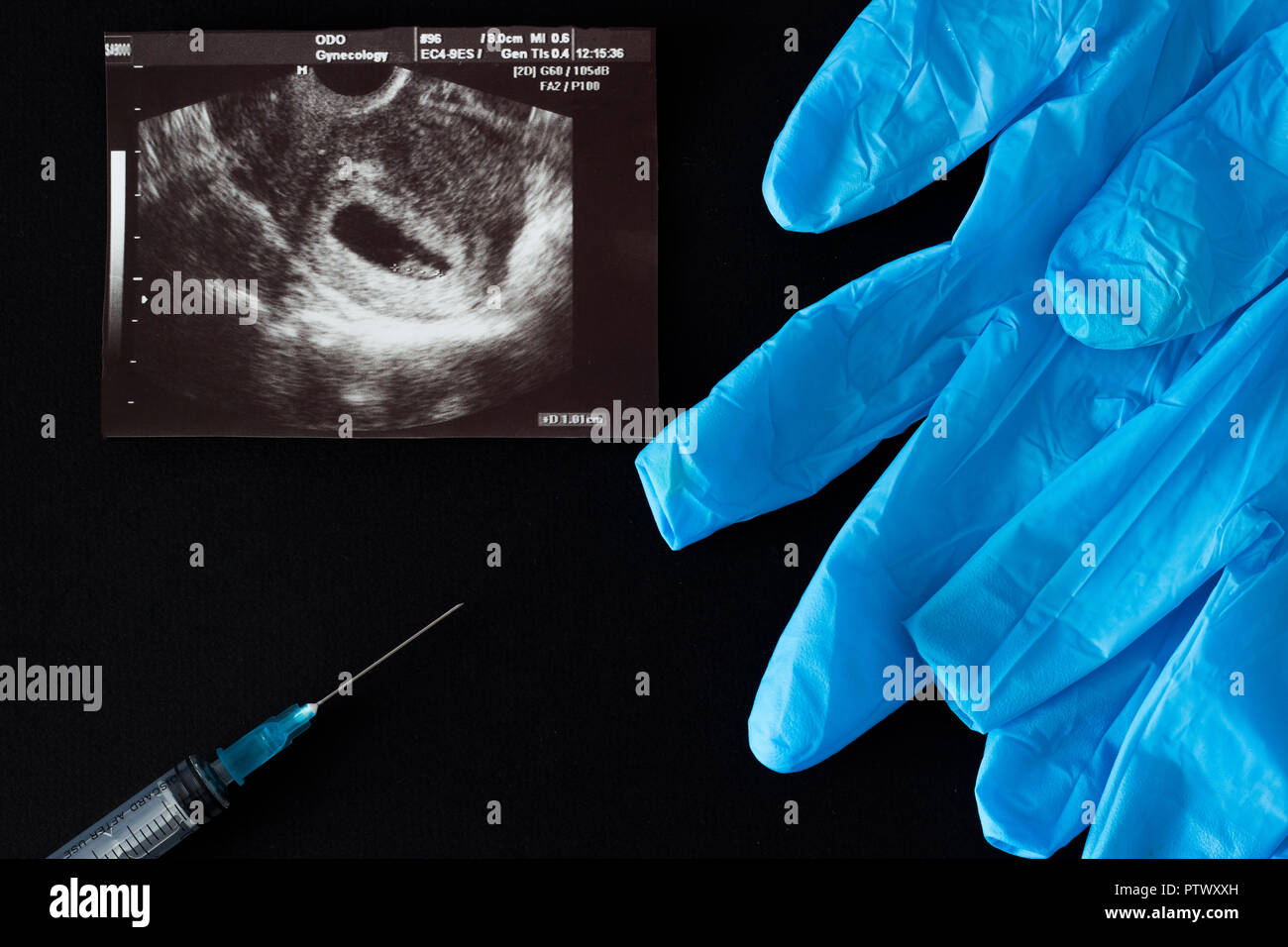 L aborto, il test di gravidanza risultato, guanti medicali e siringa, sfondo nero Foto Stock
