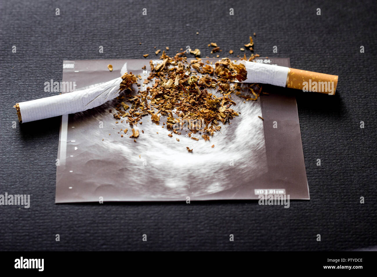 Rotture di sigaretta su una foto di gravidanza uzi, il fumo e la gravidanza, la gestazione e la sigaretta Foto Stock