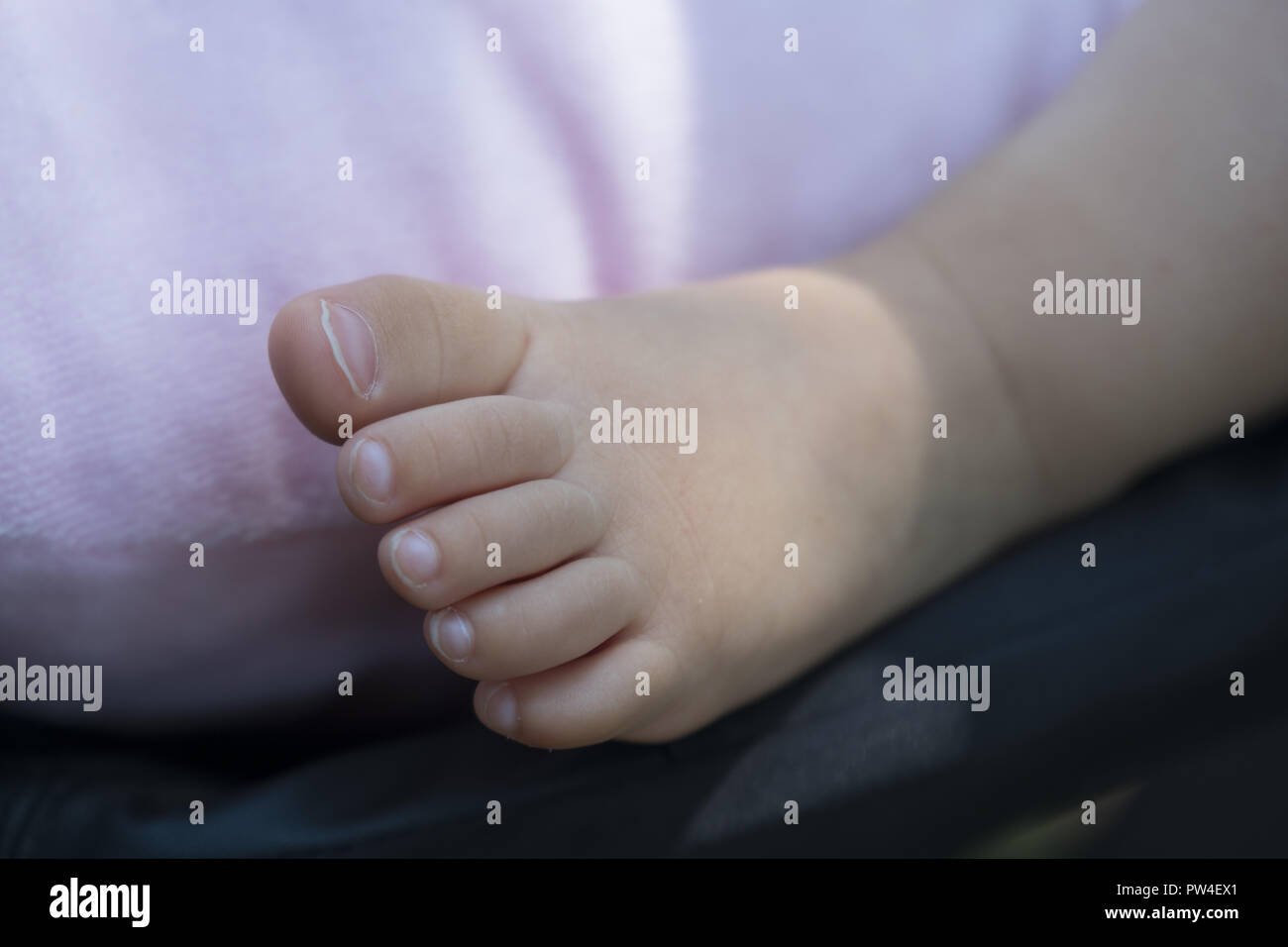 Gara al piede di un sei mesi Baby girl. Foto Stock