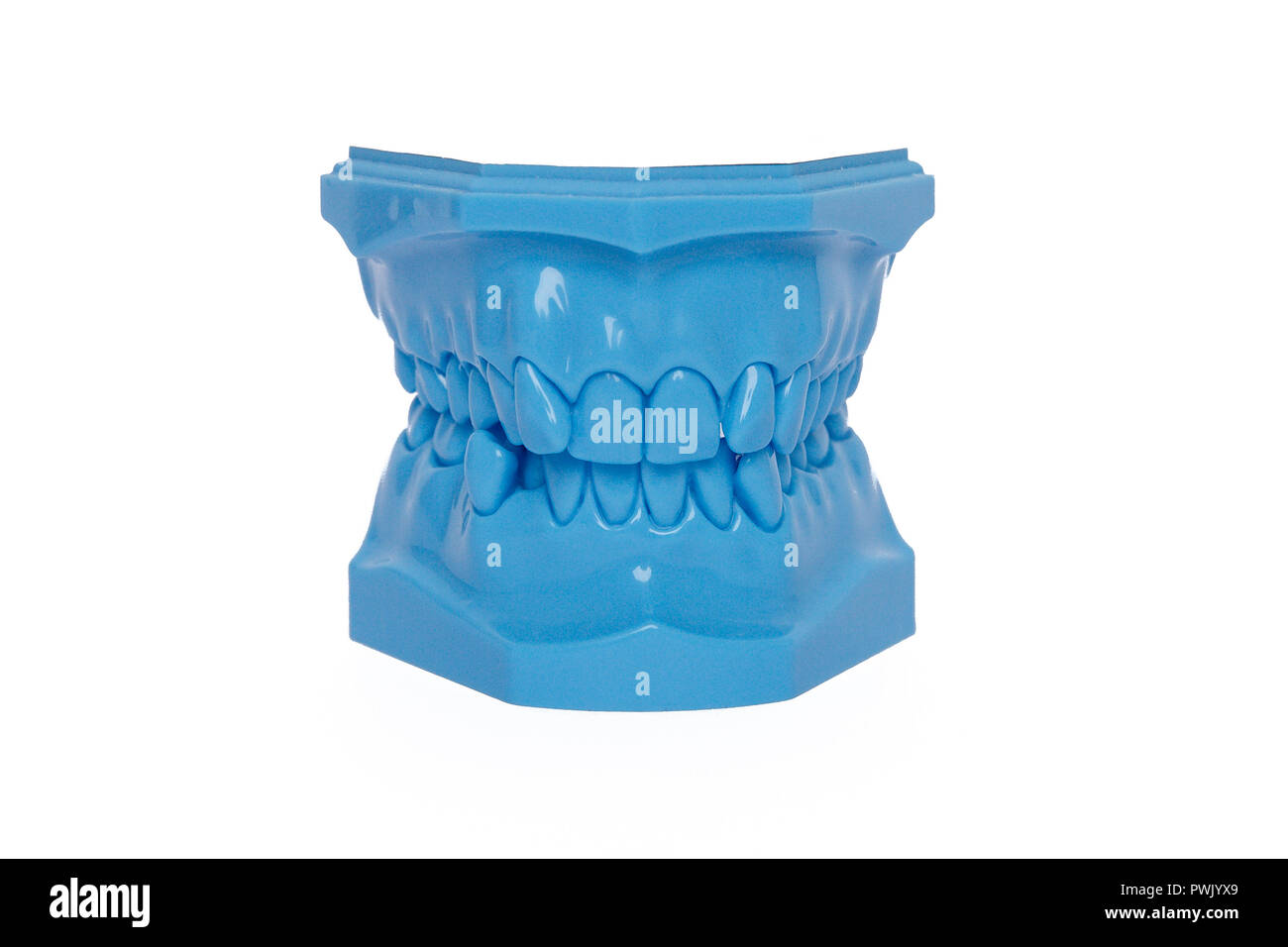 Blu denti ortodontico modello utilizzato in odontoiatria per la dimostrazione e la finalità educativa. Foto Stock