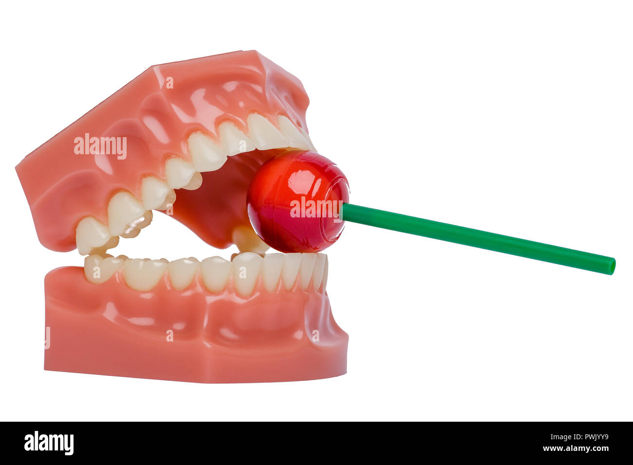 Denti ortodontico modello con red lollipop Foto Stock