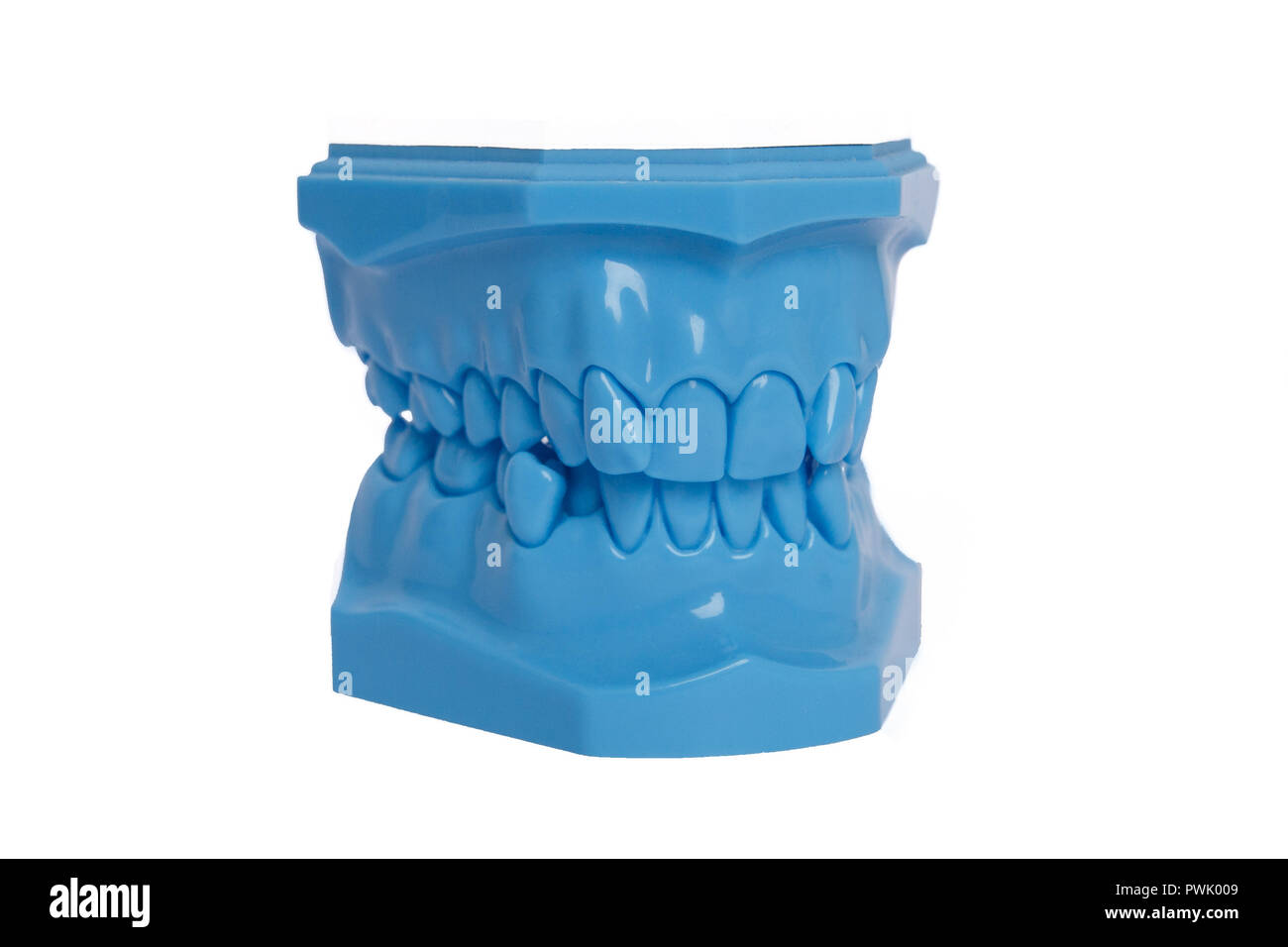 Blu denti ortodontico modello utilizzato in odontoiatria per la dimostrazione e la finalità educativa. Foto Stock