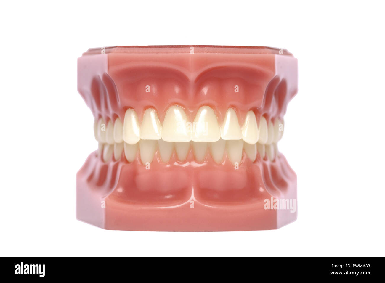 Modello ortodontico utilizzato in chirurgia odontoiatrica per la dimostrazione e l'istruzione. Foto Stock