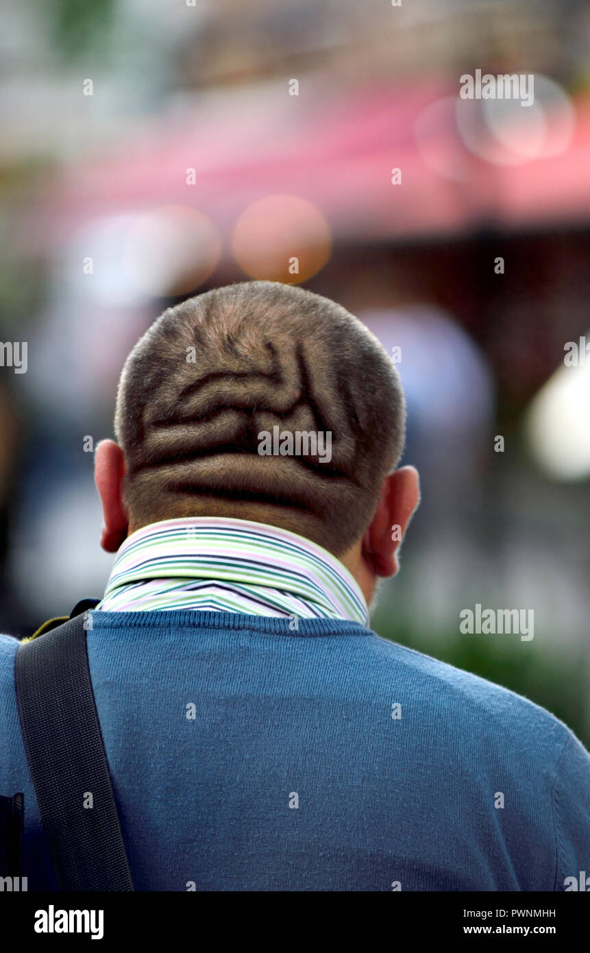 Uomo che mostra i sintomi della cute verticis gyrata (CVG) - una condizione medica associata con ispessimento del cuoio capelluto che può mostrare visibili pieghe, pliche Foto Stock