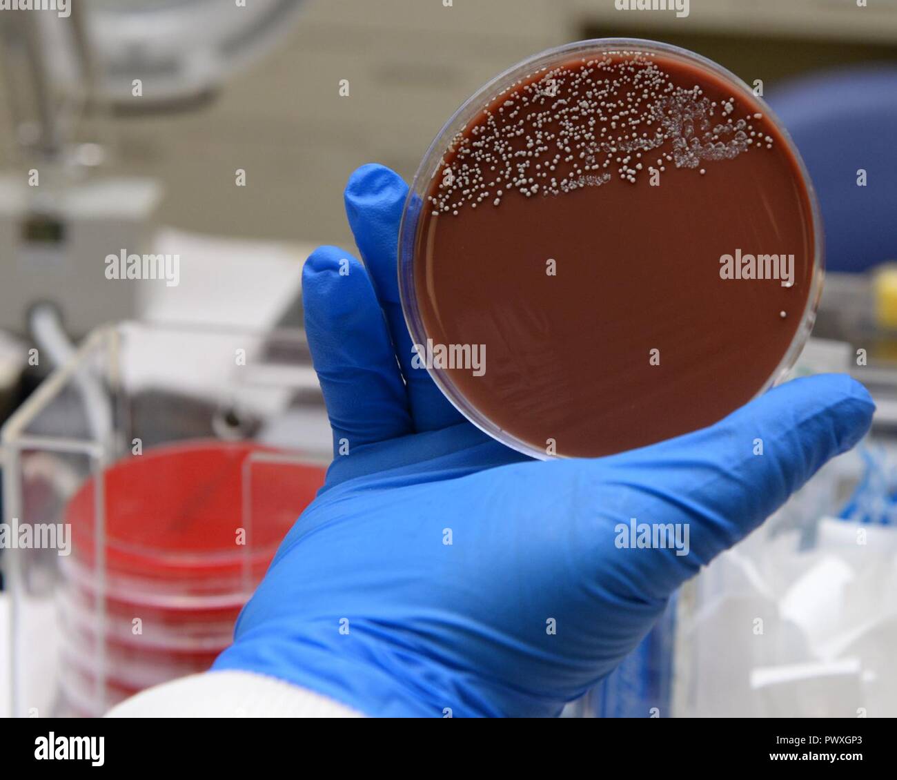 Erin Penney, 88th diagnostica e terapeutica di microbiologia squadrone technical supervisor, identifica un cioccolato piastra di agar campione da un paziente all'interno della cultura il laboratorio di microbiologia a Wright-Patterson Air Force Base Medical Center il 30 giugno 2017. Agar cioccolato è un mezzo nutritivo utilizzato nella coltivazione di organismi particolarmente esigenti come Neisseria e Haemophilis specie. Foto Stock