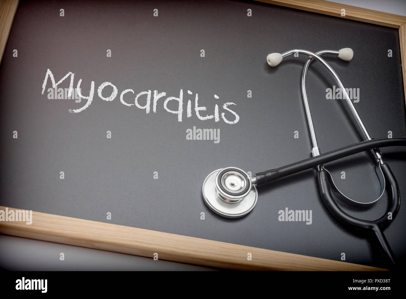 Miocardite parola scritta in gesso su una lavagna nera accanto a uno stetoscopio, immagine concettuale Foto Stock