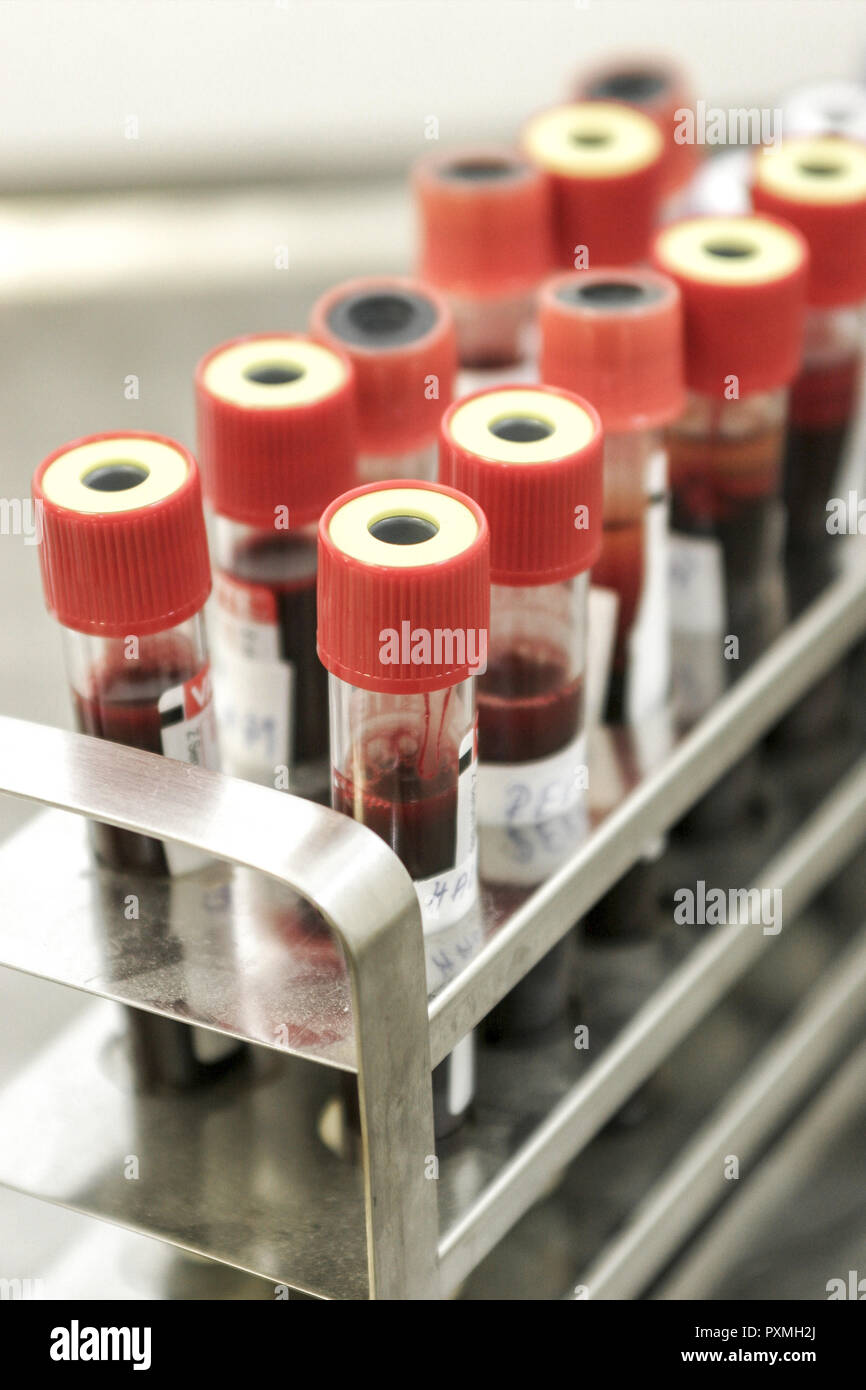 Behaelter, Biologie, Blut, Blutprobe, Bluttest, Blutuntersuchung, diagnosticare Diagnostik, Forschung, guarigione libro, Histologie, Krankheit, Laboratorium, Foto Stock