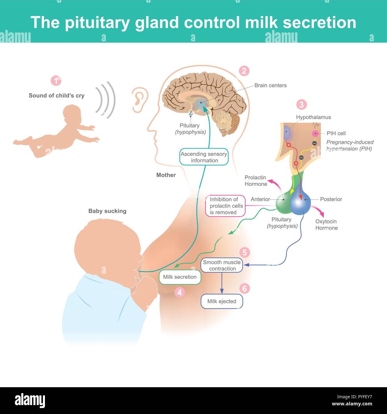 Quando la madre sente il bambino piangere. Il cervello attiva la gravidanza indotta da ipertensione cella (PIH) fornire latte di mammella. Illustrazione Vettoriale