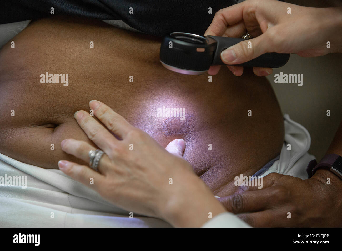 Medico esamina il paziente per la malattia della pelle Foto Stock
