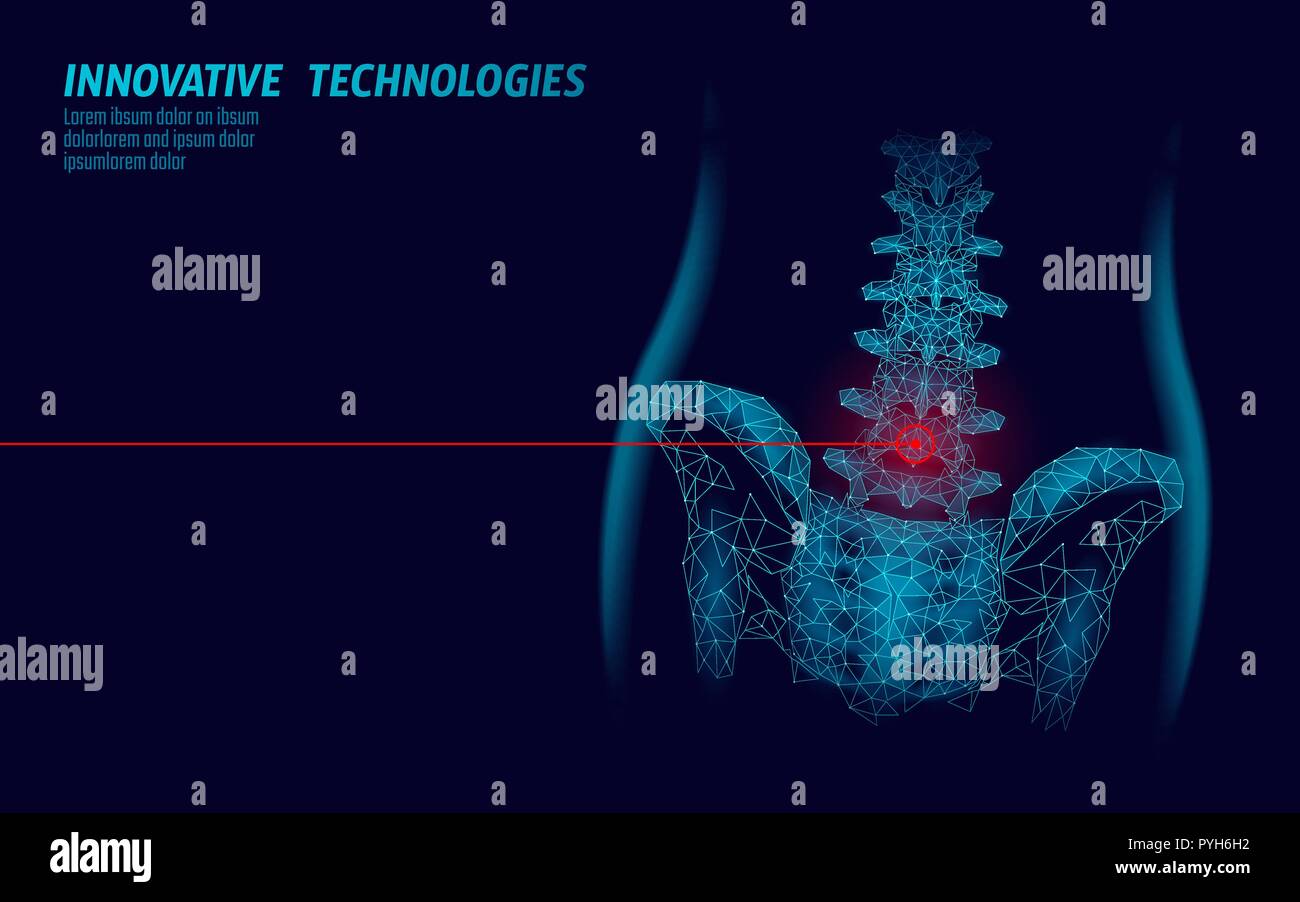 Colonna vertebrale umana hip radiculitis lombare dolore bassa poli. Geometrica delle particelle poligonali triangolo linea punto la medicina del futuro della tecnologia Blu rosso area dolorosa illustrazione vettoriale Illustrazione Vettoriale