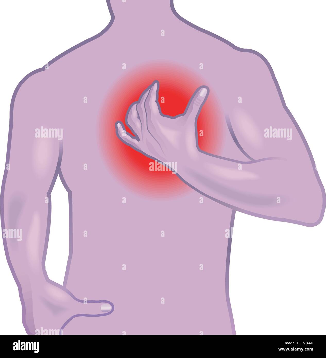 Silhouette di uomo che mostra segni di condizione medica infarto illustrato su bianco. Illustrazione Vettoriale
