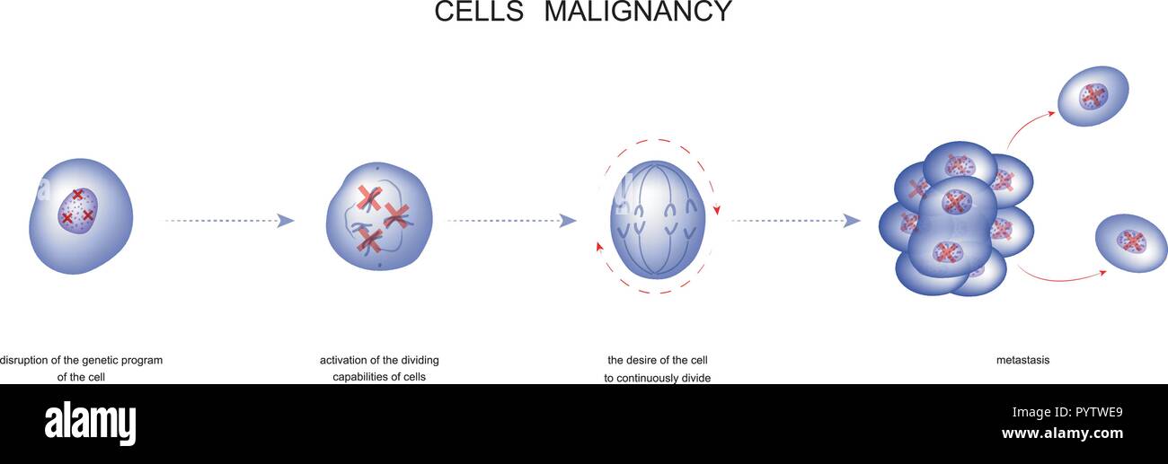 Illustrazione vettoriale di un processo di cellule di tumore maligno Illustrazione Vettoriale