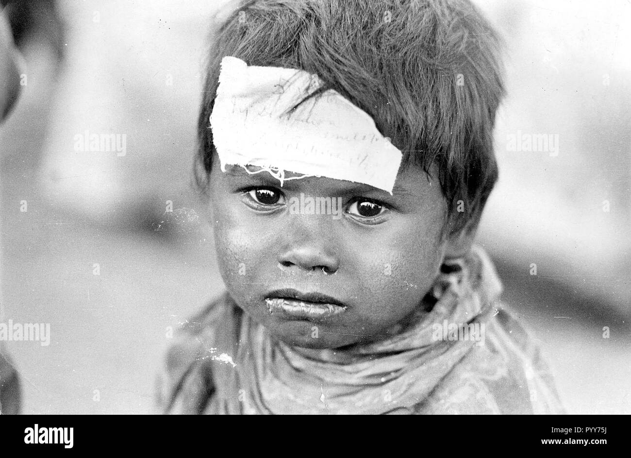 Bambino malato, Union Carbide perdita di gas tragedia, Bhopal, Madhya Pradesh, India, Asia Foto Stock