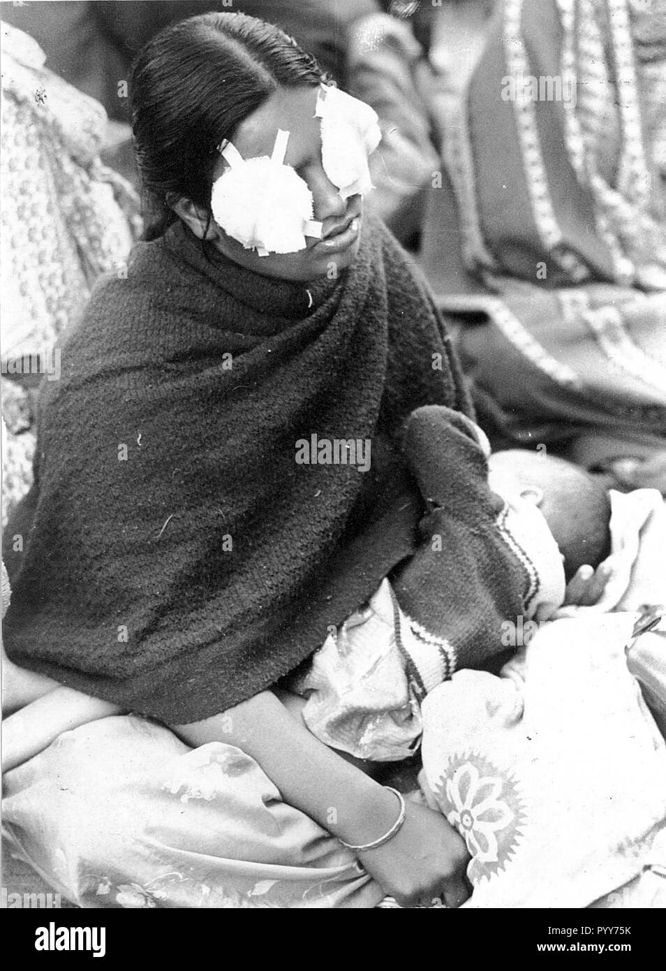 Donna occhi banditi, Union Carbide fuga di gas tragedia, Bhopal, Madhya Pradesh, India, Asia, Disastro di Bhopal, tragedia del gas di Bhopal, 1984, vecchia immagine vintage del 1900s Foto Stock