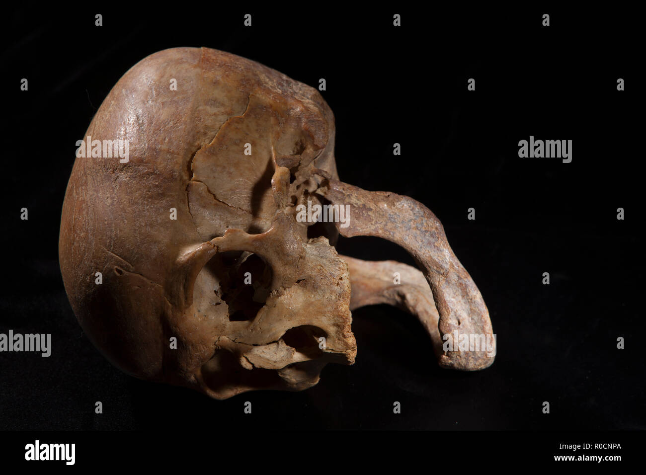 Cranio umano isolato su sfondo nero Foto Stock