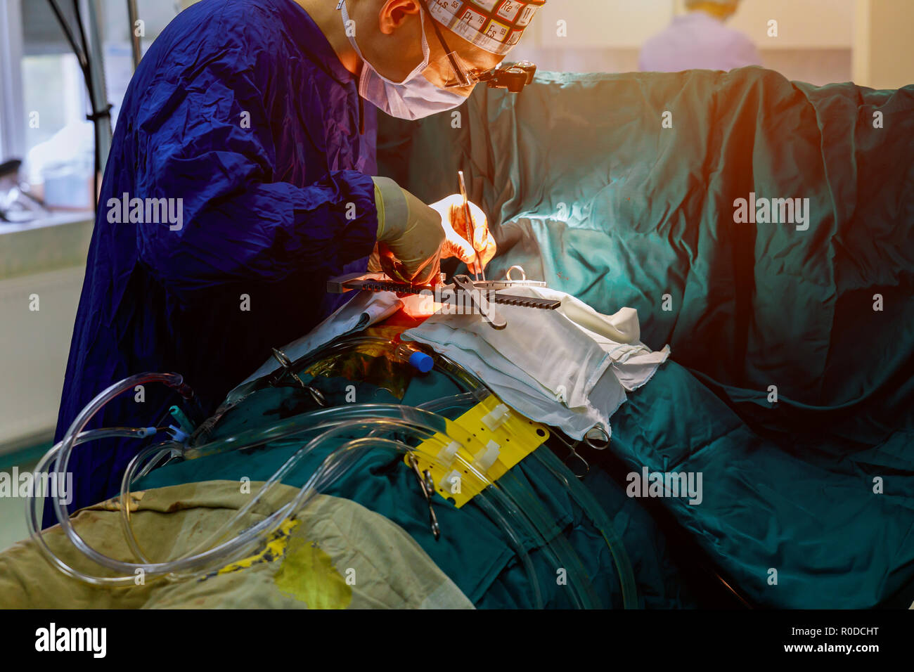 Chirurgo azionando live shot chirurghi team cuore operativo. Foto Stock