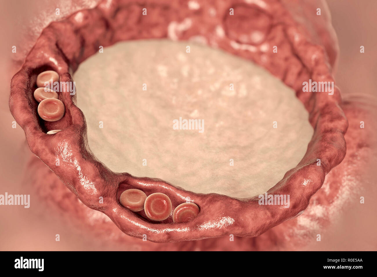 Cellule Negli Alveoli Immagini E Fotos Stock Alamy