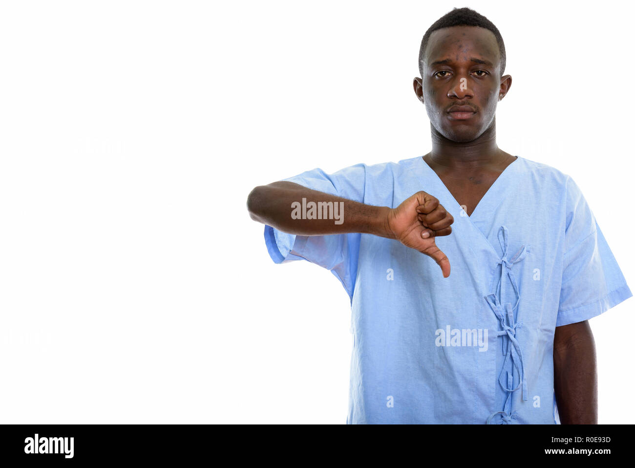Studio shot del giovane africano nero uomo paziente dando il pollice verso il basso Foto Stock