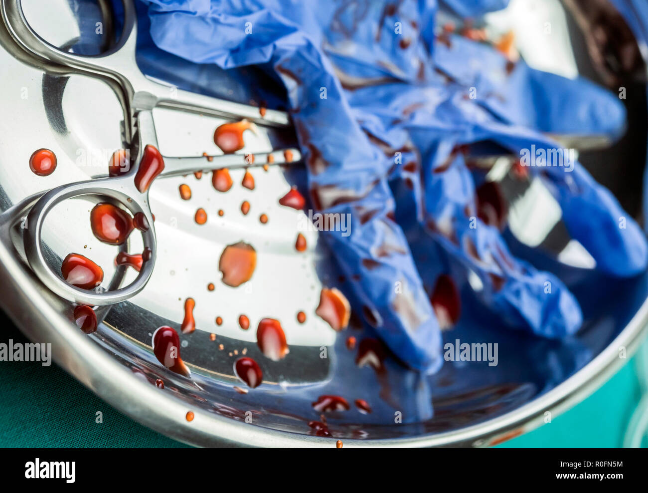 Guanti blu e forbici macchiato di sangue su un vassoio in un teatro operativo, immagine concettuale Foto Stock