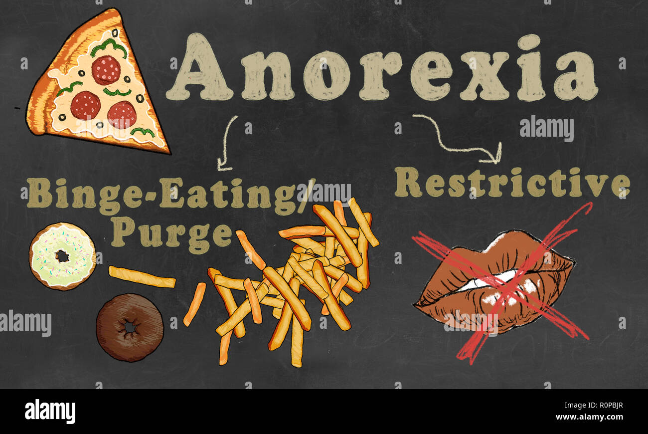 Anoressia illustrato con la classificazione. Due tipi: Binge-Eating/spurgo e restrittivi disturbo alimentare Foto Stock