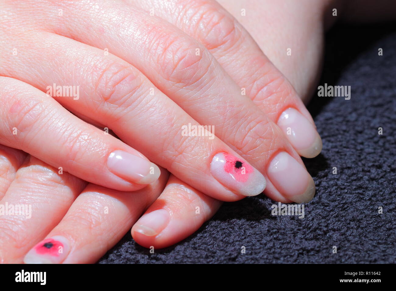 Dipinto di unghie con un ricordo di papavero applicato. Foto Stock