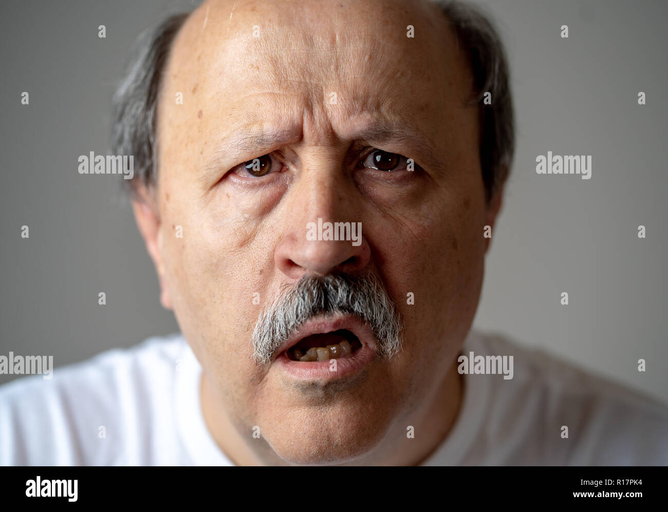 Close up ritratto di senior man looking confusi e smarriti affetti da demenza, la perdita di memoria o il morbo di Alzheimer in salute mentale in adulti più anziani e più tardi Foto Stock