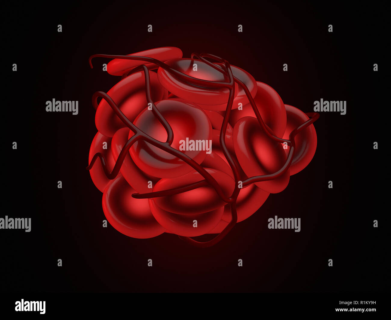 3d illustrazione di illustrazione di un coagulo di sangue, trombi ed emboli con coagulato le cellule rosse del sangue. Foto Stock