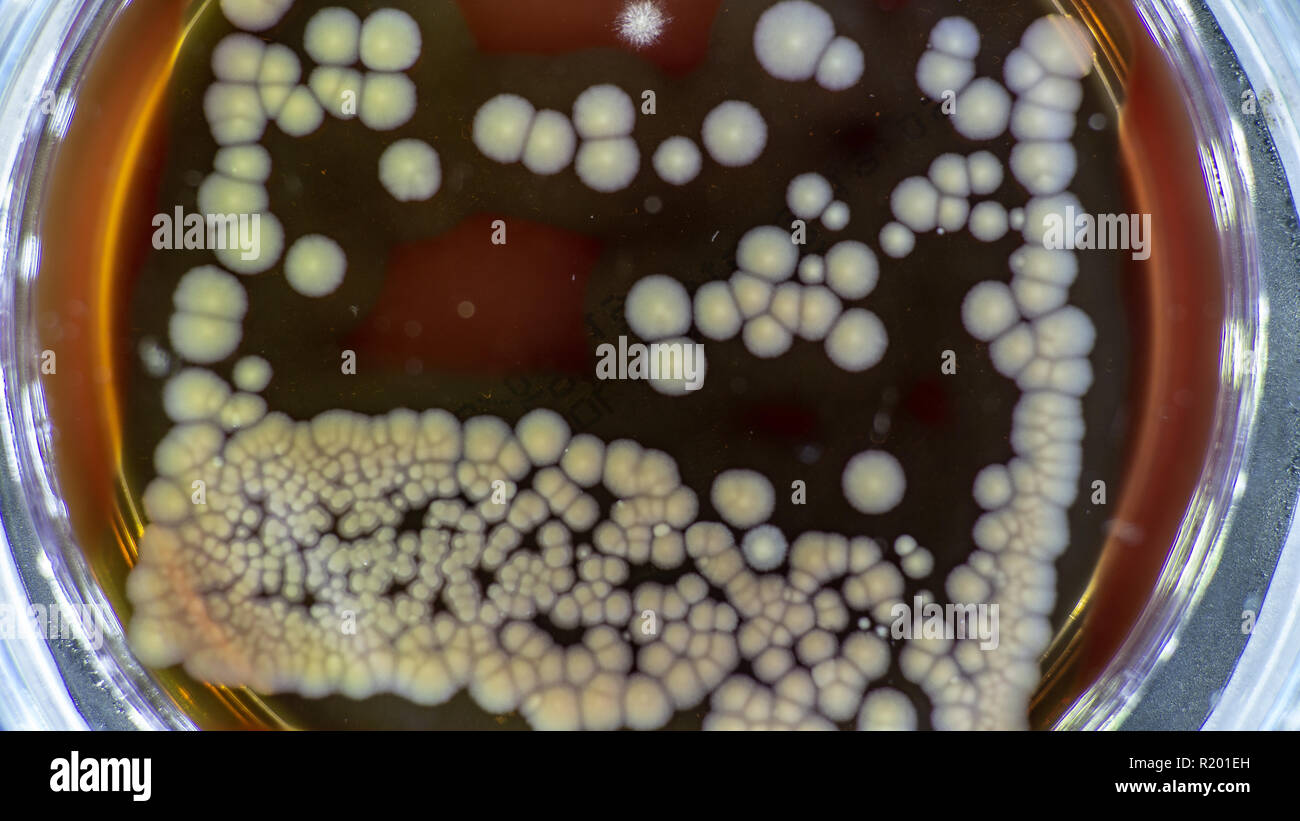 Piastra di petri con batteri, colonia batterica il prelievo per la clonazione di DNA Foto Stock