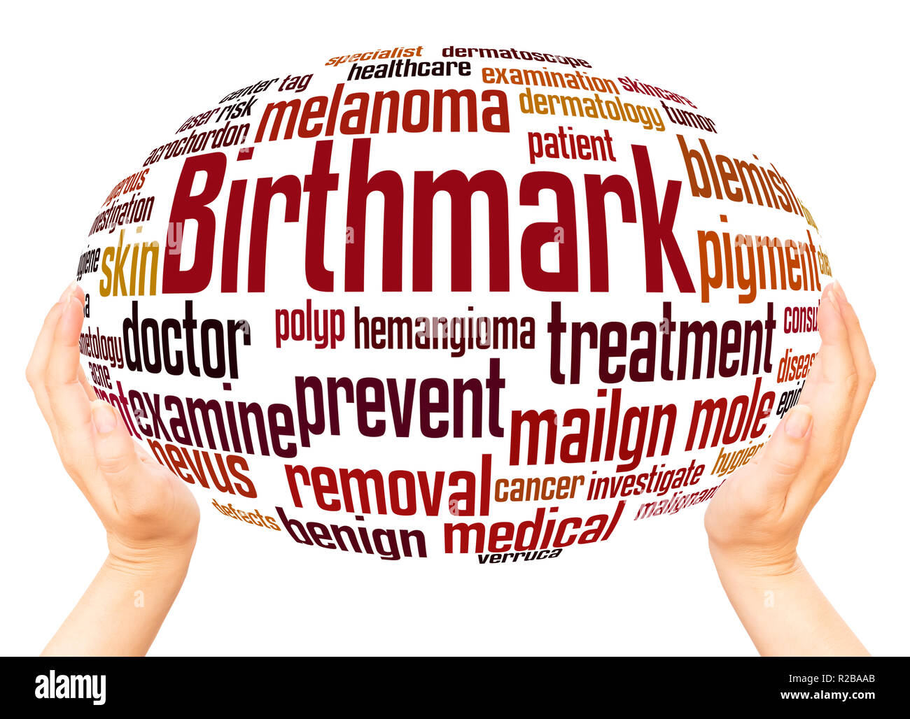 Birthmark word cloud sfera mano concetto su sfondo bianco. Foto Stock