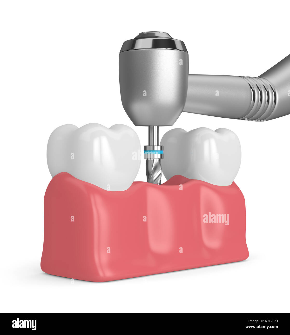 3D render di denti con trapano dentistico. Impianto dentale concept Foto Stock