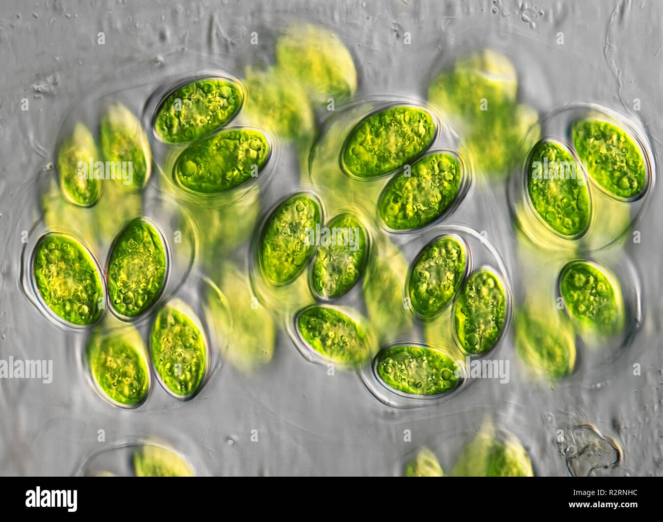 Le alghe in moro,400 x Foto Stock