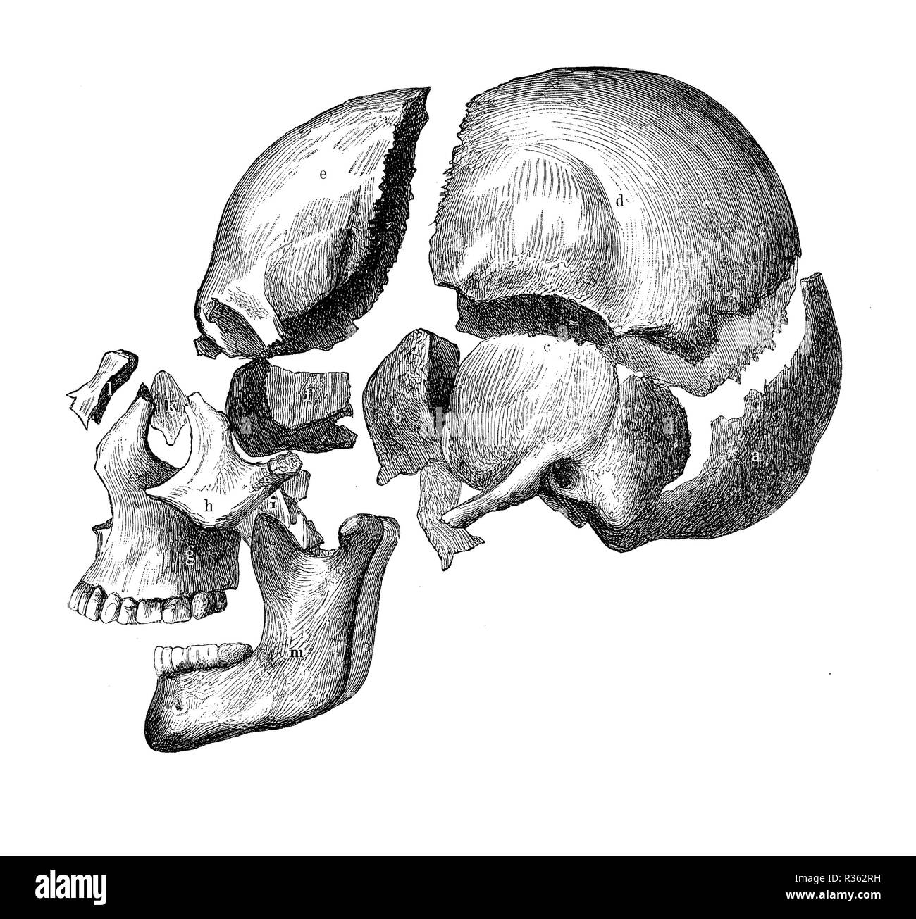 Vintage illustrazione di anatomia, cranio con ganascia e denti, osso vista di decomposizione Foto Stock