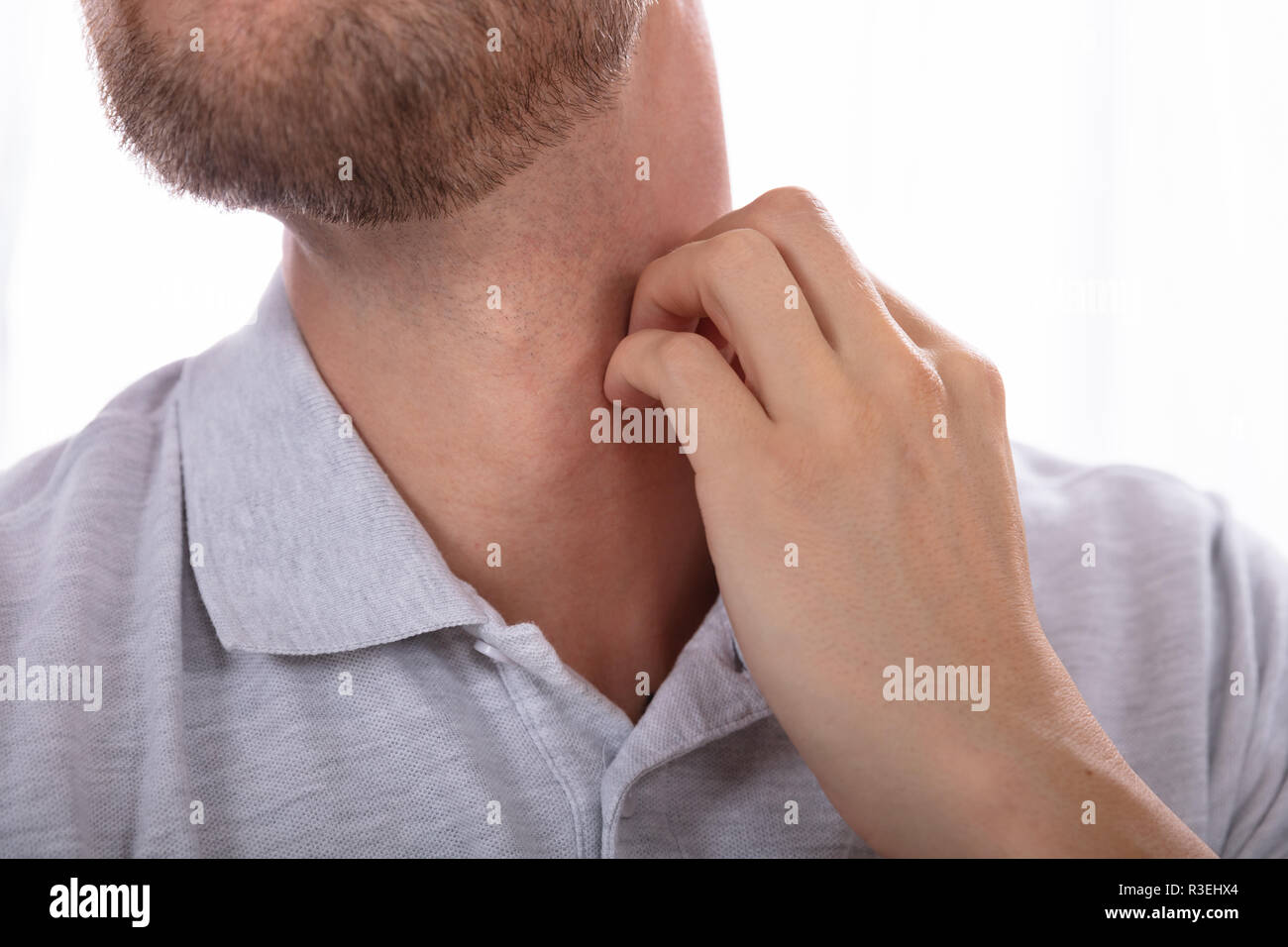Close-up di una mano di un uomo di graffiare il suo collo Foto Stock