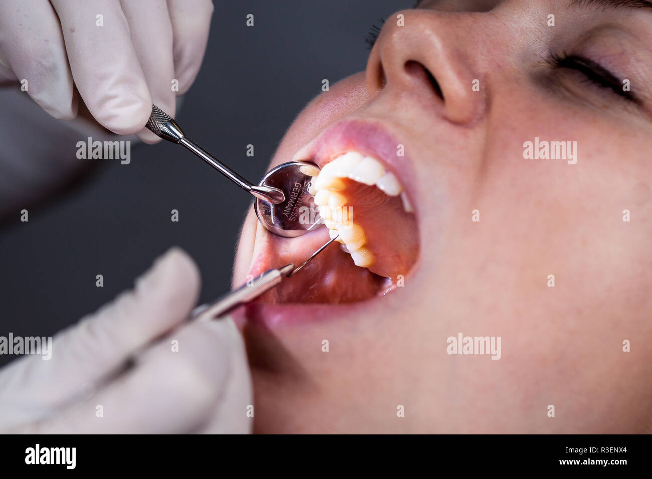 presso il dentista Foto Stock