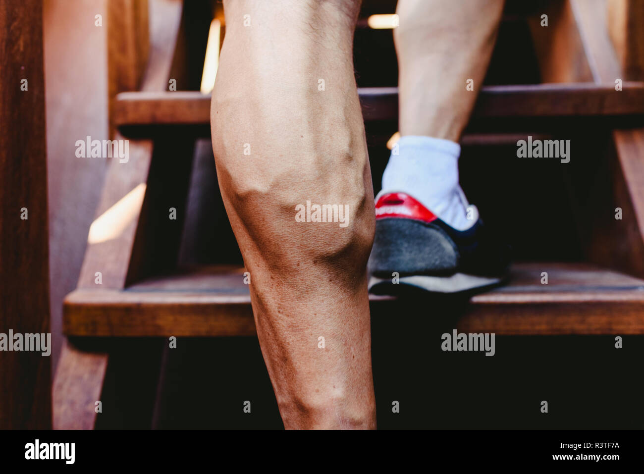Grandi vene visibili dei muscoli del polpaccio in un uomo della gamba. Foto Stock