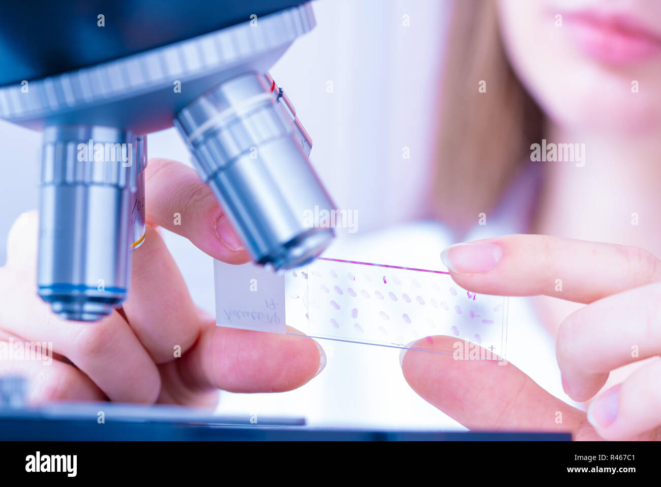 Scienziato analizzando vetrino del microscopio in laboratorio. Giovane donna tecnico sta esaminando un campione istologico, una biopsia in laboratorio di cancro ri Foto Stock