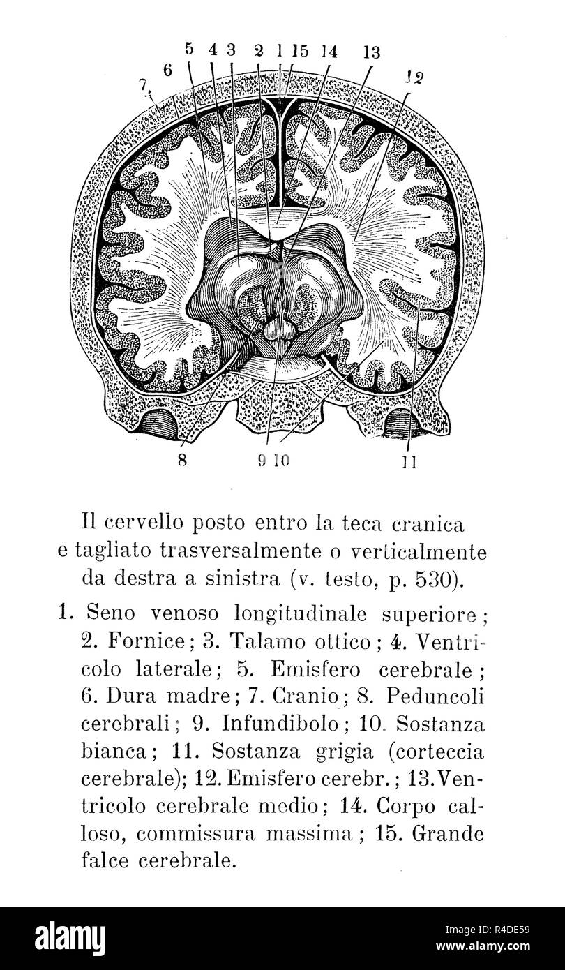 Vintage illustrazione di anatomia, il cervello umano in sezione trasversale nel cranio, descrizioni anatomiche in italiano Foto Stock