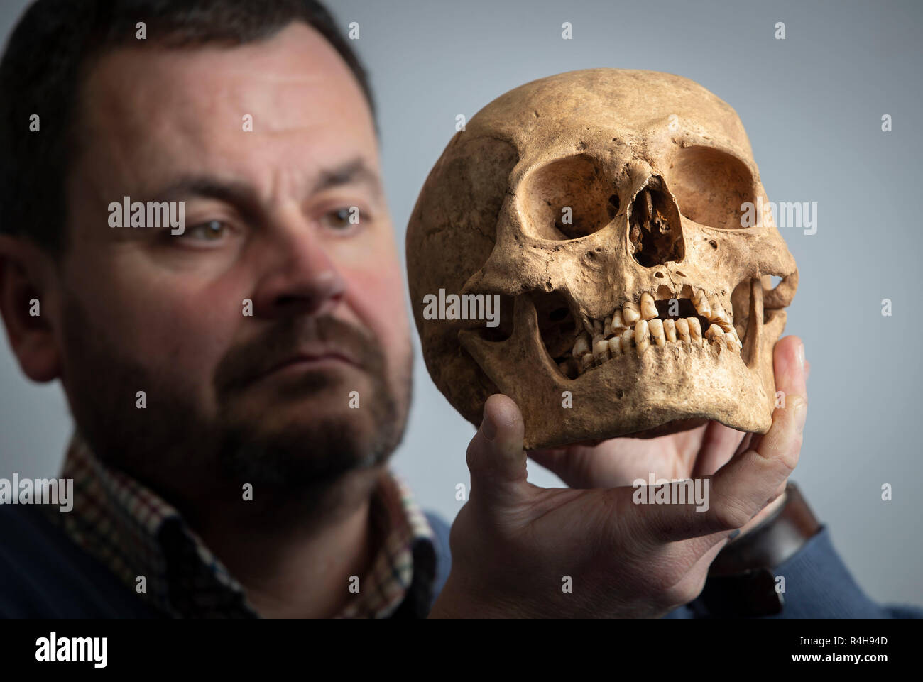 Dr Hugh Willmott, Senior Lecturer in unione Archeologia Storica dell'Università di Sheffield, detiene un teschio umano che è stato scoperto durante gli scavi presso un precedentemente sconosciuto cimitero anglosassone che dissotterrato sontuoso sepolture di donne con i loro gioielli e oggetti personali. Foto Stock