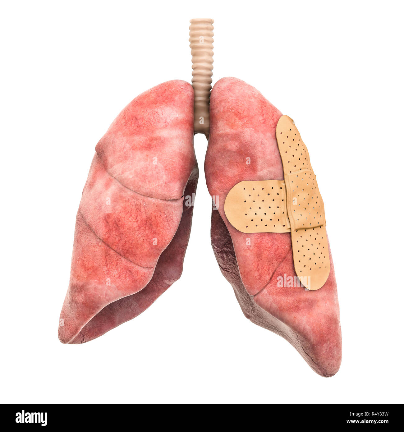 Polmoni umani con fasce adesive. Trattamento dei polmoni concetto, 3D rendering isolati su sfondo bianco Foto Stock