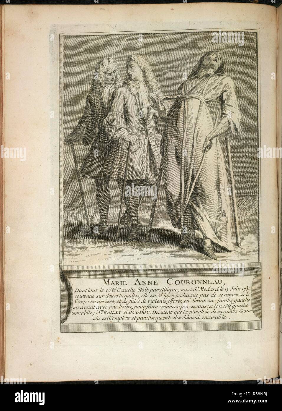 Marie Anne Couronneau. La vía©ritÃ© des miracles opÃ©rÃ©s Ã l'intercessione de. [Paris,] 1737. Due medici discutere la disabilità di Marie Anne Couronneau chi può essere visto su stampelle. Immagine presa da La vía©ritÃ© des miracles opÃ©rÃ©s Ã l'intercessione de M. de Paris et autres appellans, dÃ©montrÃ©e contre M. l'archevÃªque de Sens. Originariamente pubblicato/prodotto in [Paris,] 1737. . Fonte: 3902.g.40.(1), dopo 46. Lingua: Francese. Foto Stock