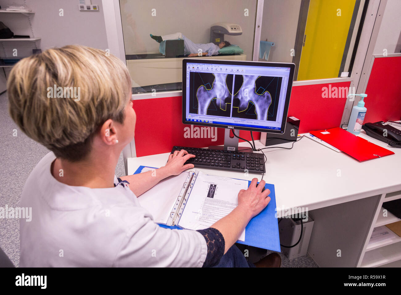 Un medico utilizza un osso Densitometro per misurare la densità ottica del collo del femore del paziente di sesso femminile per la diagnosi di osteoporosi, Angouleme hospit Foto Stock
